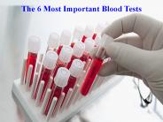 The 6 Most Important Blood Tests