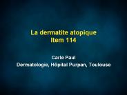 La dermatite atopique Item 114
