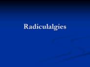 Radiculalgies