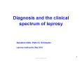 Diagnosis and the clinical spectrum of leprosy PowerPoint PPT Presentation