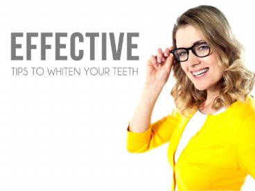 Effective Tips to Whiten Your Teeth