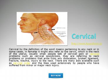 Cervical Collar