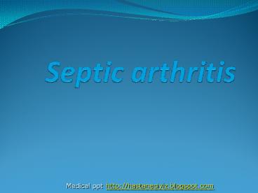 Septic arthritis