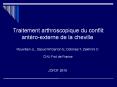 Traitement arthroscopique  du Conflit antero-externe de la                 cheville PowerPoint PPT Presentation