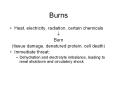 Burns PowerPoint PPT Presentation