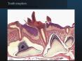Tooth eruption PowerPoint PPT Presentation