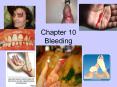 Chapter 10 Bleeding PowerPoint PPT Presentation