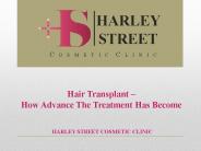 Hair Transplant – How Advance The Treatment Has Become