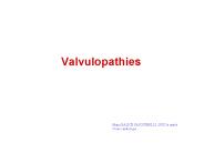 Valvulopathies