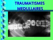 TRAUMATISMES  MEDULLAIRES