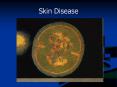 Skin Disease PowerPoint PPT Presentation