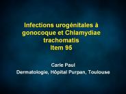 Infections urog