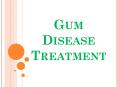 Gum Disease Treatment PowerPoint PPT Presentation
