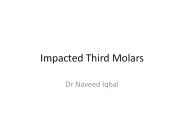 impacted third molars