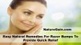 Easy Natural Remedies For Razor Bumps To Provide Quick Relief PowerPoint PPT Presentation