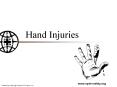 Hand Injuries PowerPoint PPT Presentation