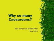 Why so many Caesareans?