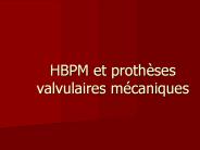 HBPM et proth