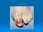 Cf cour Dr MESSER