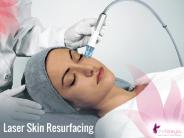 Laser Skin Resurfacing