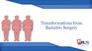 The Positive Effects of Bariatric Surgery - 2015