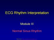 ECG Rhythm Interpretation