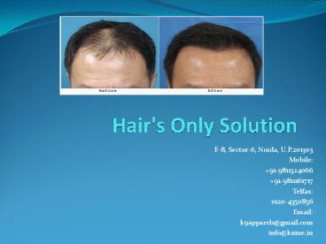 Hair's Only Solution (2)