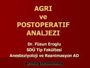 AGRI ve POSTOPERATIF ANALJEZI