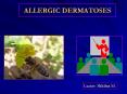 ALLERGIC%20DERMATOSES PowerPoint PPT Presentation