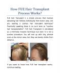 How Fue Hair Transplant Process Works? PowerPoint PPT Presentation