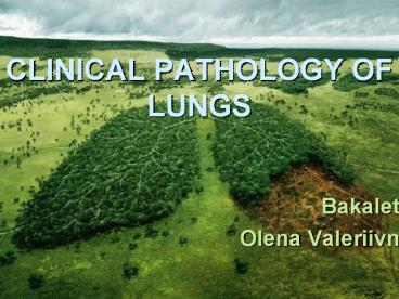 CLINICAL PATHOLOGY OF LUNGS