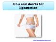 Do's and don’ts for liposuction PowerPoint PPT Presentation
