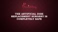The Artificial Disk Replacement Surgery is Completely Safe PowerPoint PPT Presentation
