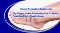 Try These Home Remedies For Athlete's Foot And Get Results Soon PowerPoint PPT Presentation