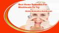 Best Home Remedies For Blackheads To Try PowerPoint PPT Presentation