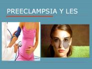 PREECLAMPSIA Y LES