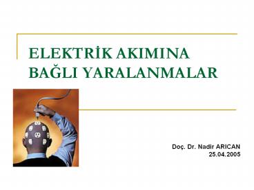 ELEKTRIK AKIMINA BAGLI YARALANMALAR