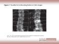 Figure 1 The effect of confounding factors on DXA images PowerPoint PPT Presentation
