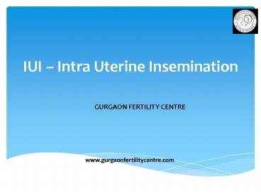 Intra Uterine Insemination