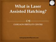 What is laser assisted Hatching