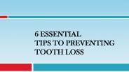 Essential Tips To Preventing Tooth Loss