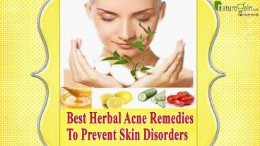 Best Herbal Acne Remedies To Prevent Skin Disorders