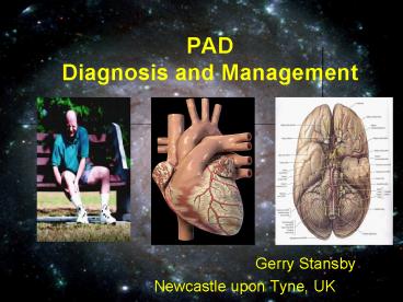 PAD Diagnosis and Management