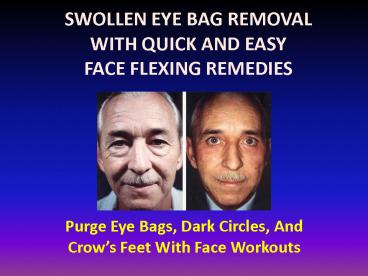 Get Rid Of Swollen Eye Bags With Facial Yoga