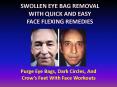 Get Rid Of Swollen Eye Bags With Facial Yoga PowerPoint PPT Presentation
