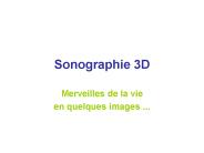 Sonographie 3D