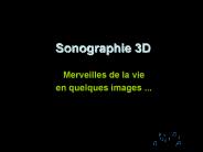 Sonographie 3D