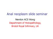 Anal%20neoplasm%20slide%20seminar