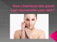 How chemical skin peels can rejuvenate your skin? PowerPoint PPT Presentation