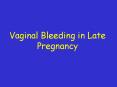 Vaginal Bleeding in Late Pregnancy PowerPoint PPT Presentation